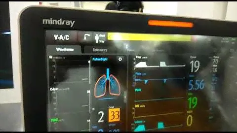 mindray Ventilator SV600